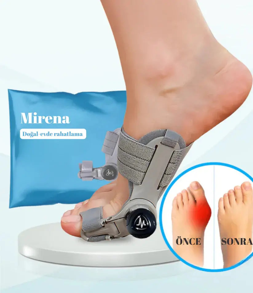 Halluks Valgus Düzeltme Aparatı MNDStore