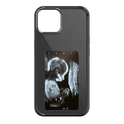 Dijital Telefon Kılıfı - MNDStore