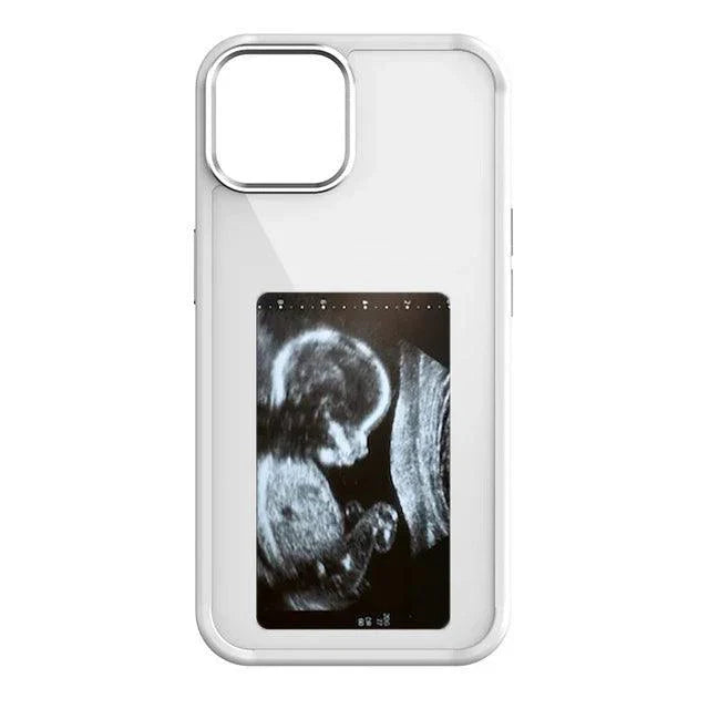 Dijital Telefon Kılıfı,nfc telefon kılıfı