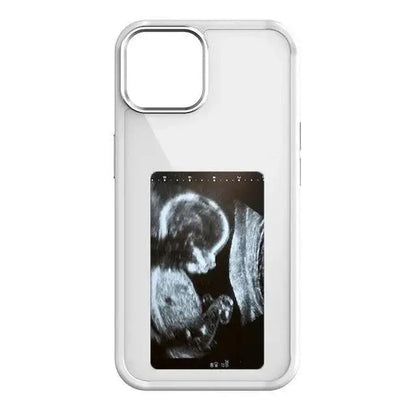 Dijital Telefon Kılıfı - MNDStore